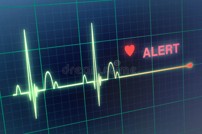 cardiac-arrest-on-cardiograph-instant-sound-effect-button-myinstants